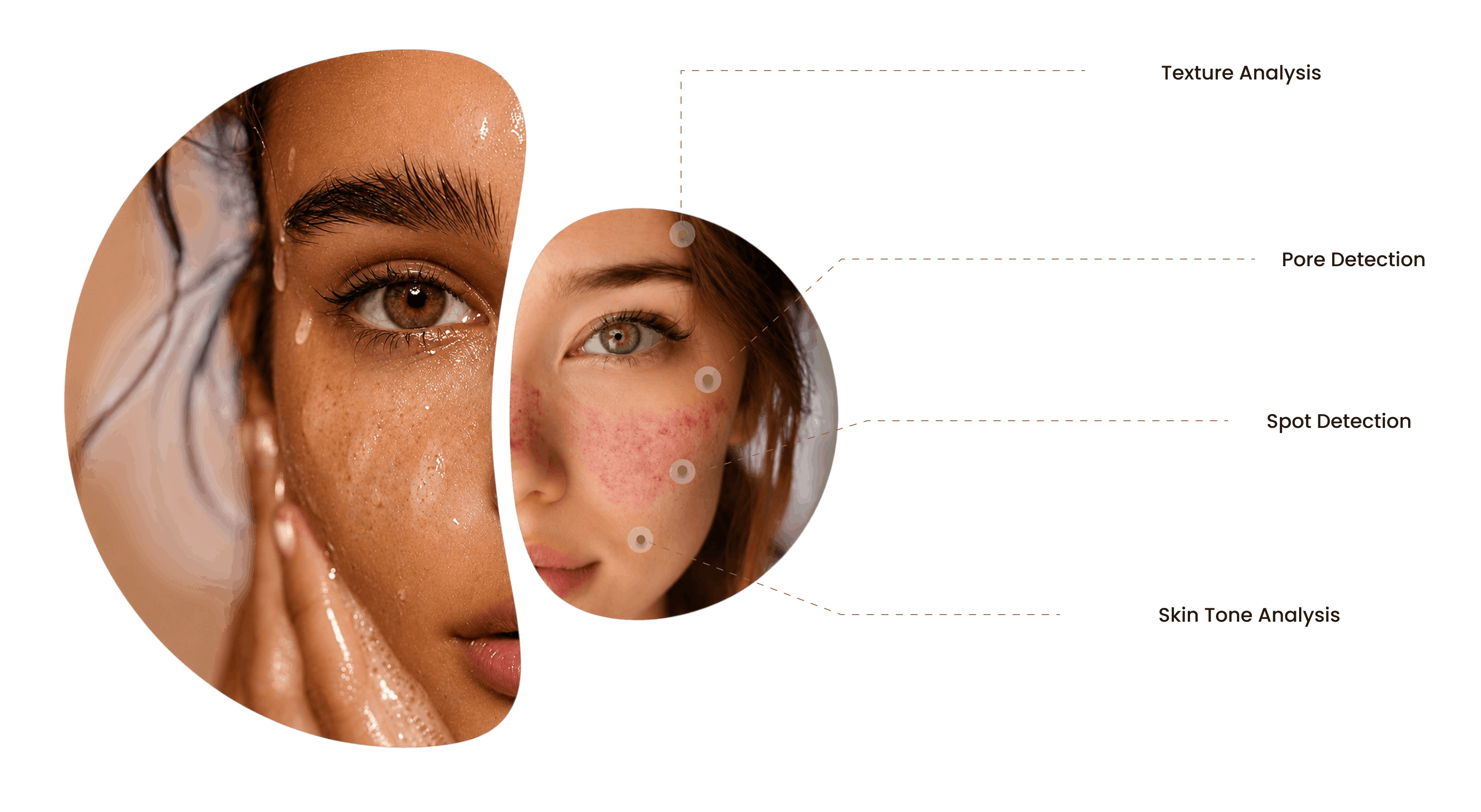 Skin Concern Analysis
